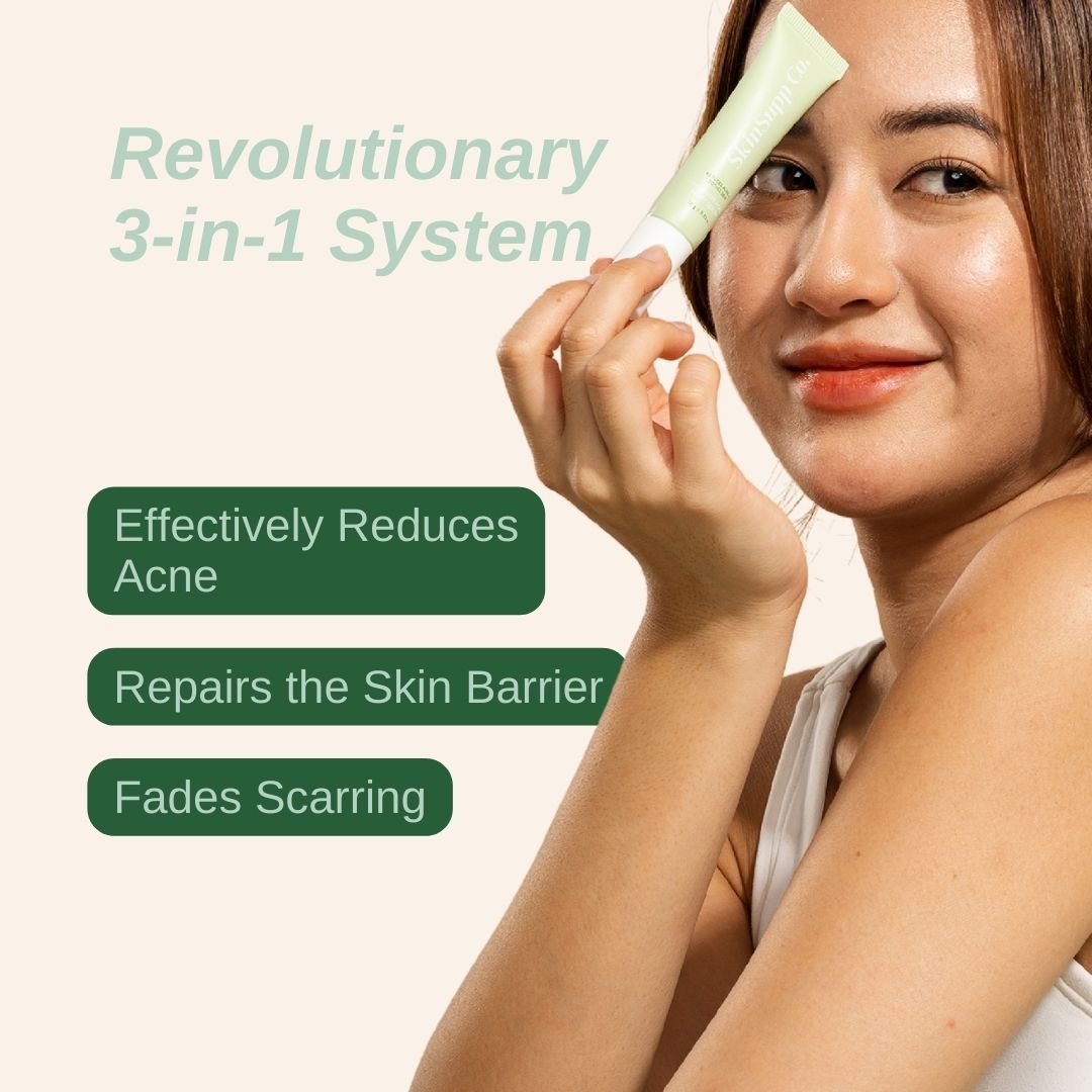 Intensive Acne Relief Serum – Arrival Online